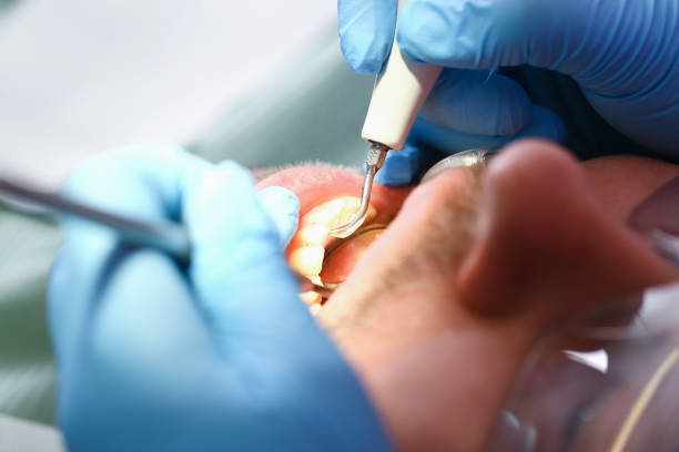 Best Emergency Broken Tooth Repair in Bell Nyon, CA