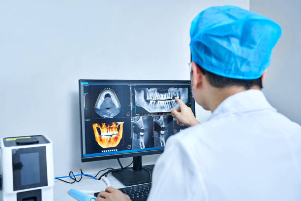 Best Emergency Tooth Extraction in Bell Nyon, CA